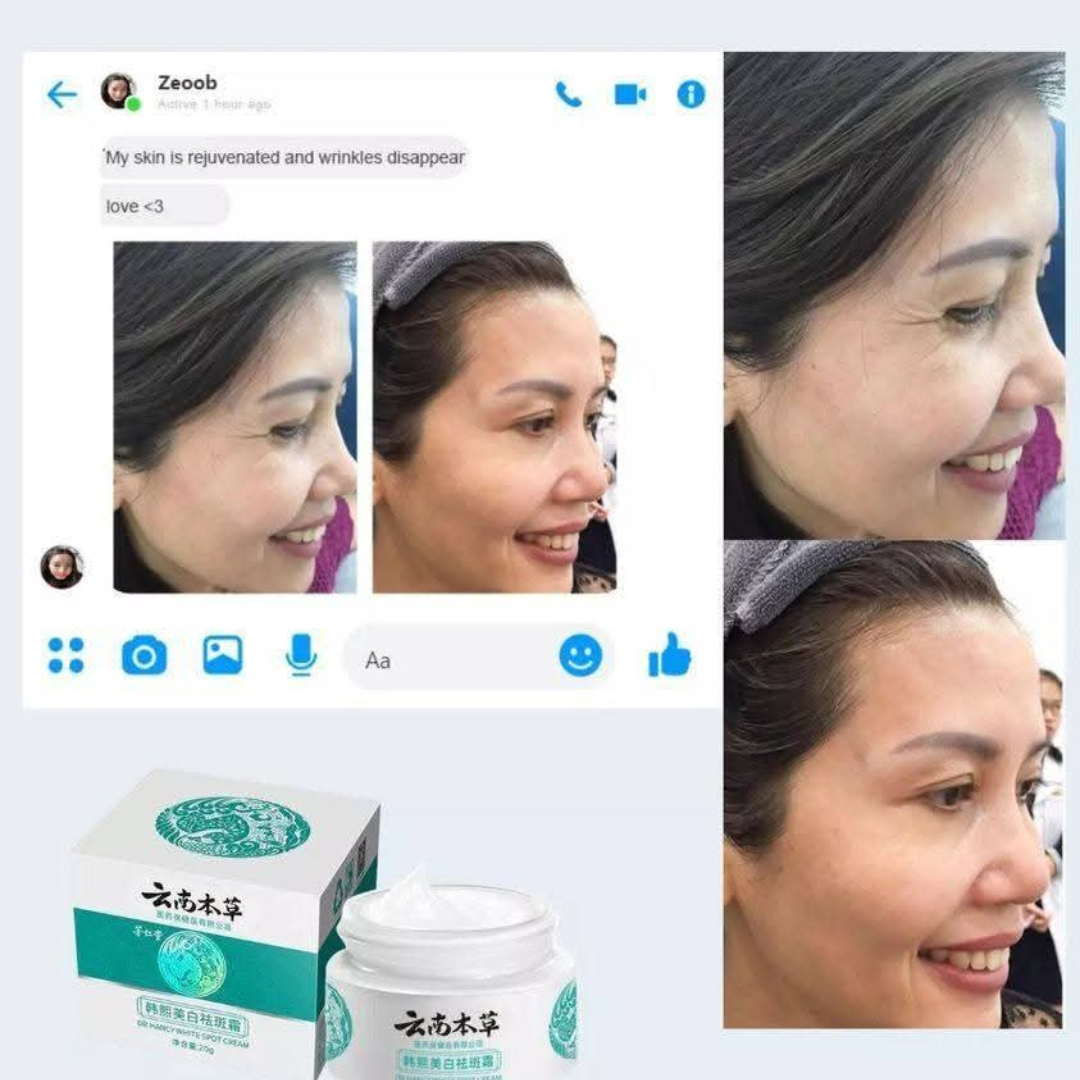 Japanese Melasma Cream, JP.HANCY Yunnan Herbal Freckle-Removing Cream, Hancy Melasma Cream, HANCY Yunnan Herbal Cream, HANCY Cream