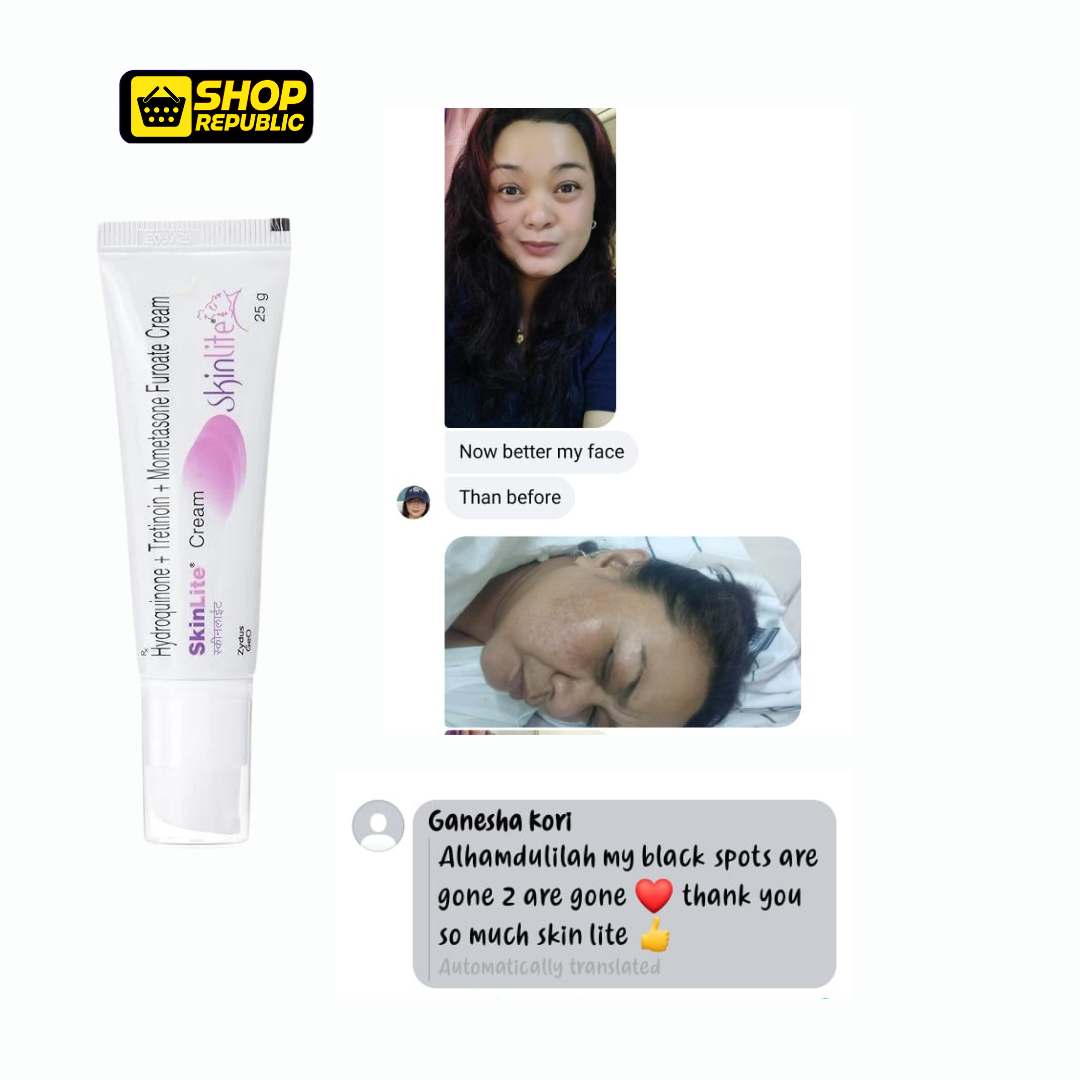 Skinlite Cream – Advanced Skin Brightening Formula (FREE Delivery)