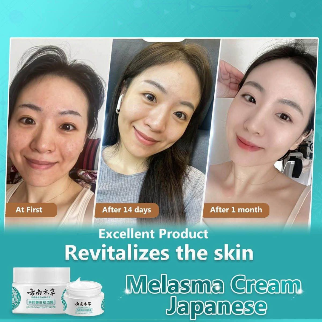 Japanese Melasma Cream, JP.HANCY Yunnan Herbal Freckle-Removing Cream, Hancy Melasma Cream, HANCY Yunnan Herbal Cream, HANCY Cream