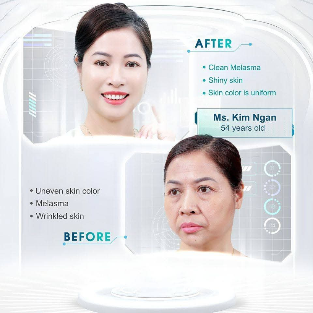 Japanese Melasma Cream, JP.HANCY Yunnan Herbal Freckle-Removing Cream, Hancy Melasma Cream, HANCY Yunnan Herbal Cream, HANCY Cream
