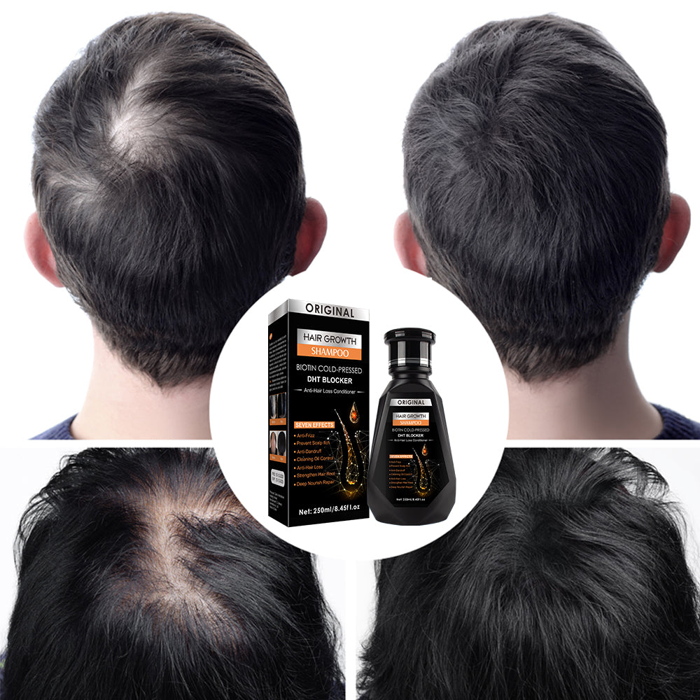 Hair Growth Power Pack – Buy 2 Biotin DHT Blocker Shampoos + Free Delivery