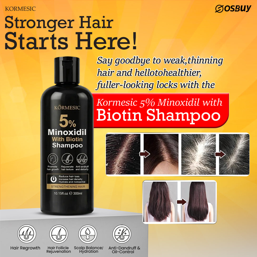 KORMESIC 5% Minoxidil Shampoo with Biotin, Hair Strengthening for Thinning Hair, 300ml