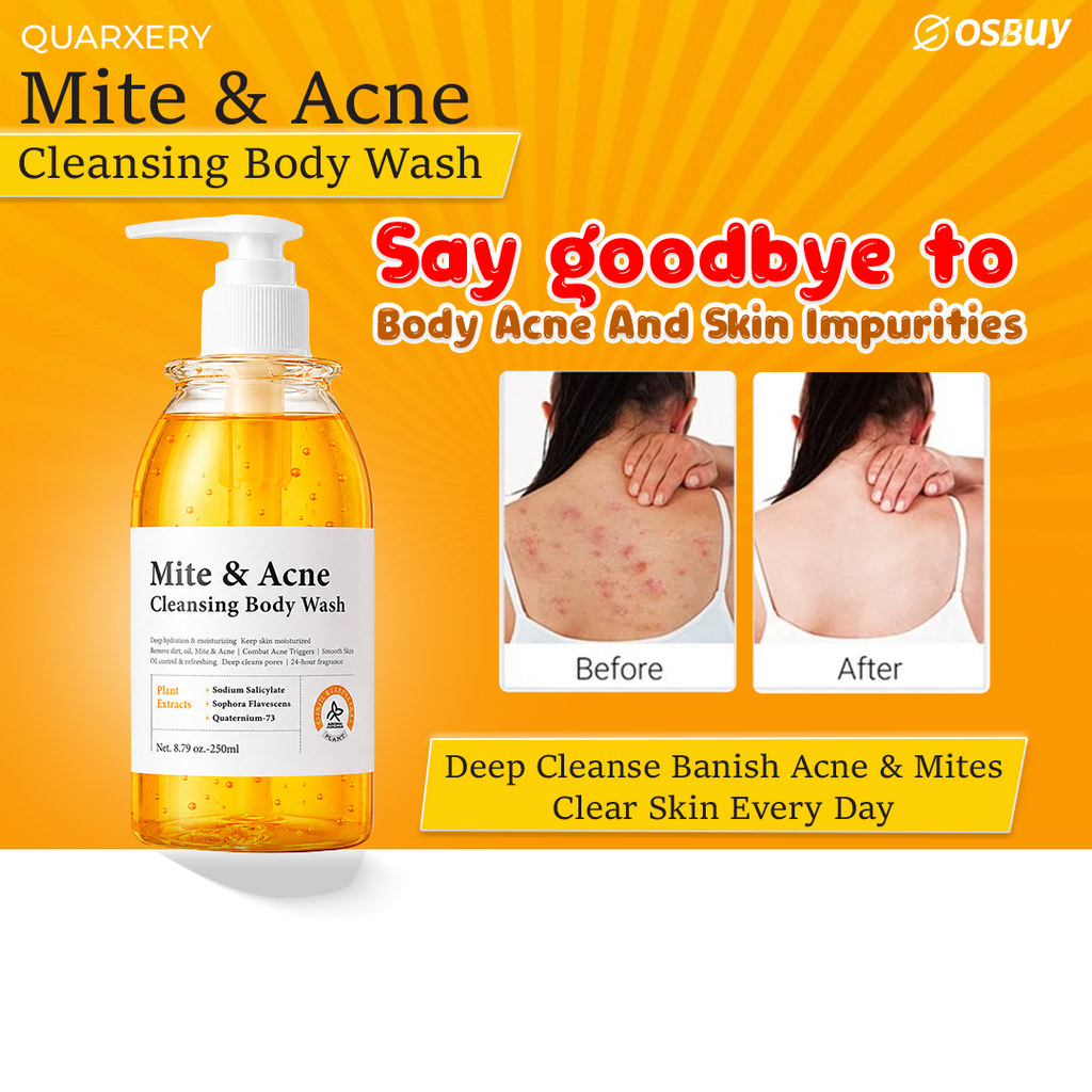 QUARXERY Body Wash Anti Acne Mite Depth Cleaning Skin And Reduce Mite Skin Antibacterial Cleaning Shower Gel