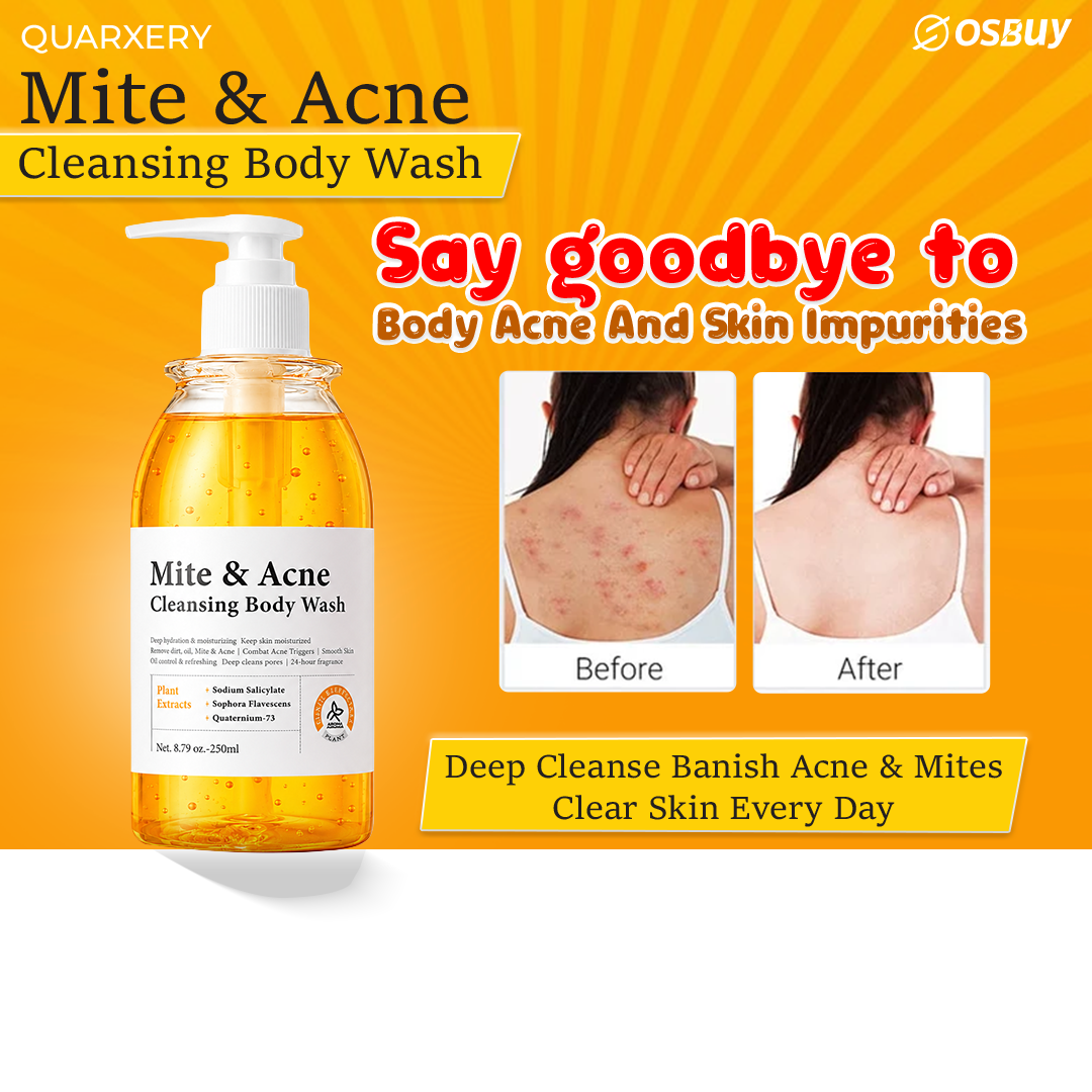 QUARXERY Body Wash Anti Acne Mite Depth Cleaning Skin And Reduce Mite Skin Antibacterial Cleaning Shower Gel
