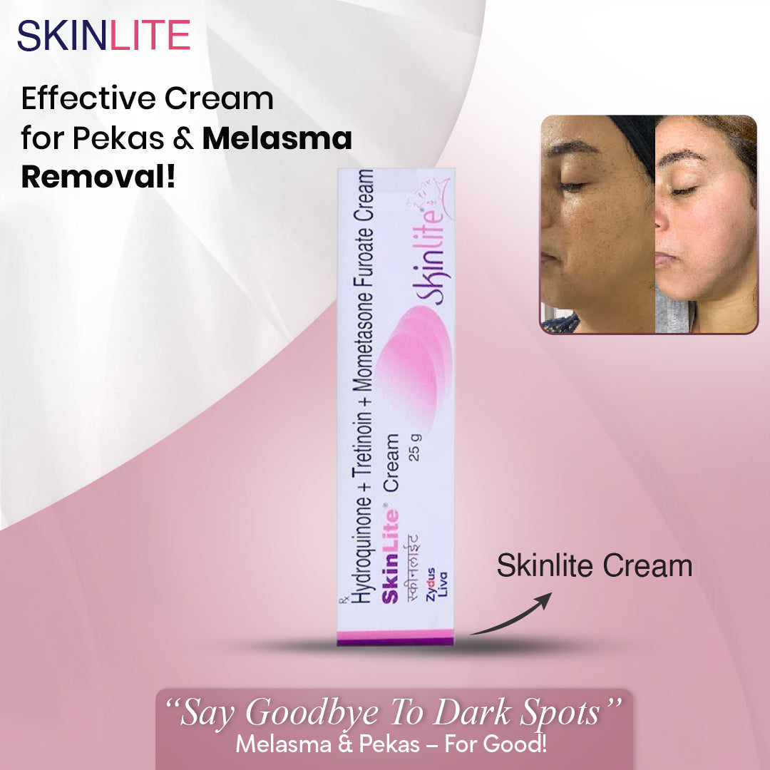 skinlite cream