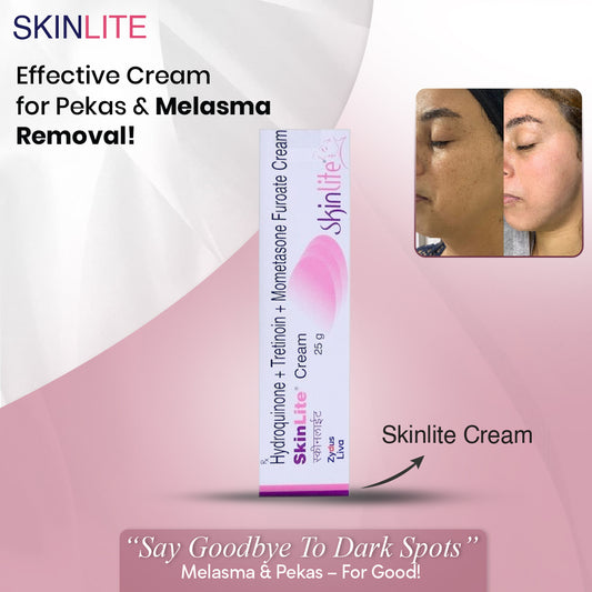skinlite cream