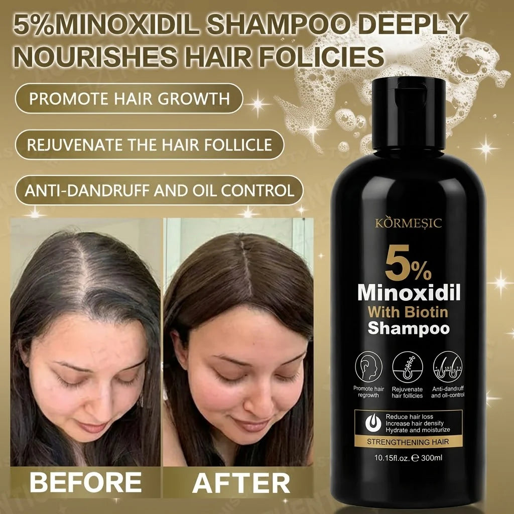 Hair Regrowth Power Duo – 2× Körmesic 5% Minoxidil Shampoo (300ml)