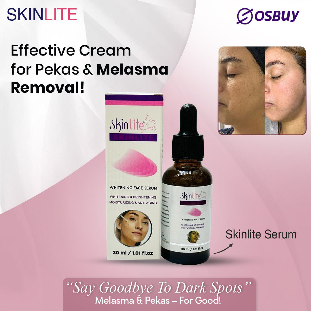 skinlite serum